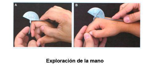 Exploración de la mano del Doctor Luis Aguilella
