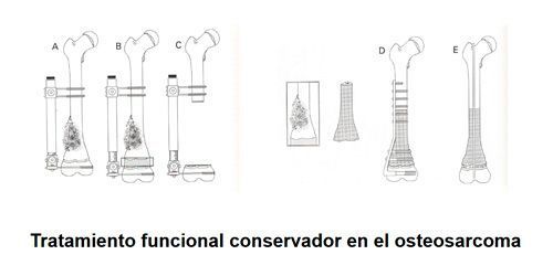 Cirugía de la mano